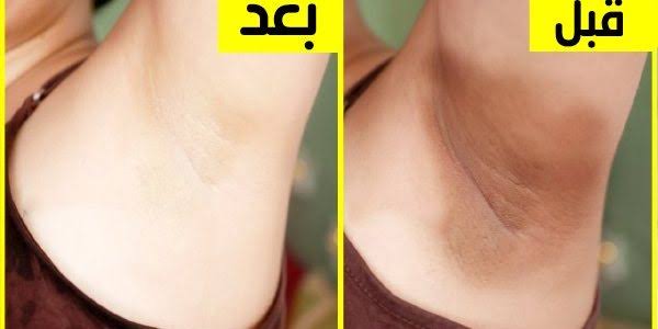 ✨ كريم Pure White Gold لتفتيح البشرة و إزالة البقع ✨ معاها هدية مجانية - Image 8